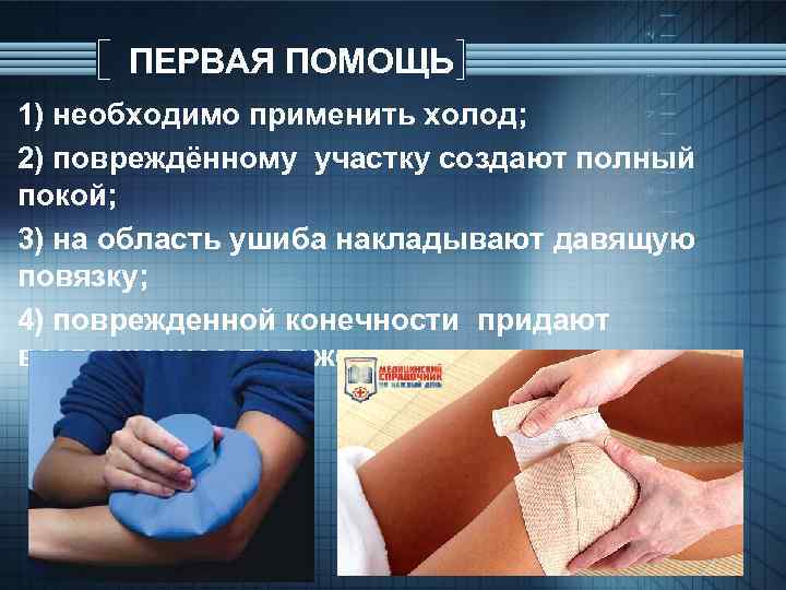ПЕРВАЯ ПОМОЩЬ 1) необходимо применить холод; 2) повреждённому участку создают полный покой; 3) на