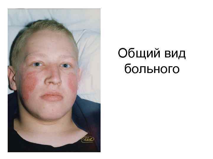 Общий вид больного 
