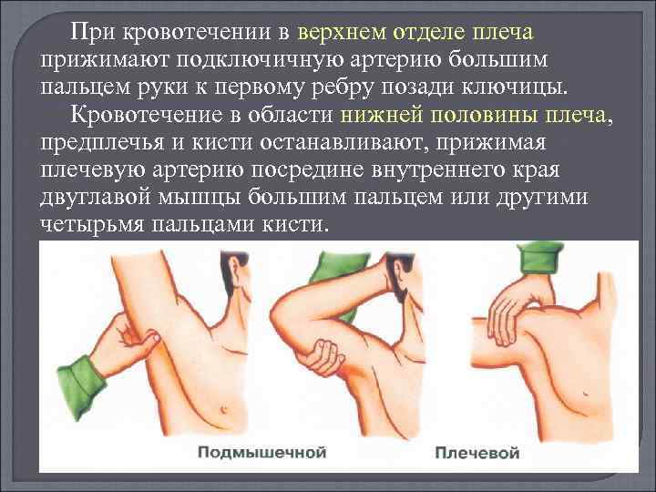 При кровотечении в верхнем отделе плеча прижимают подключичную артерию большим пальцем руки к первому