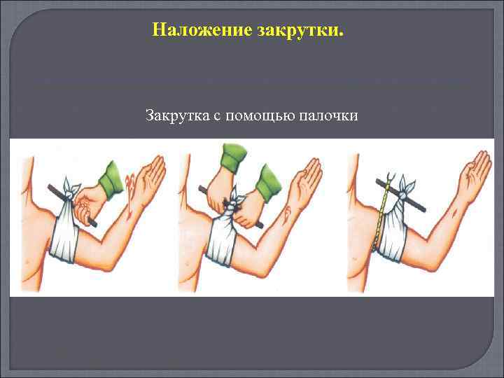 Наложение закрутки. Закрутка с помощью палочки 