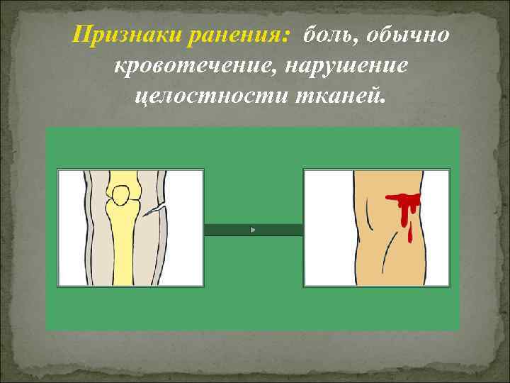 Признаки ранения: боль, обычно кровотечение, нарушение целостности тканей. 