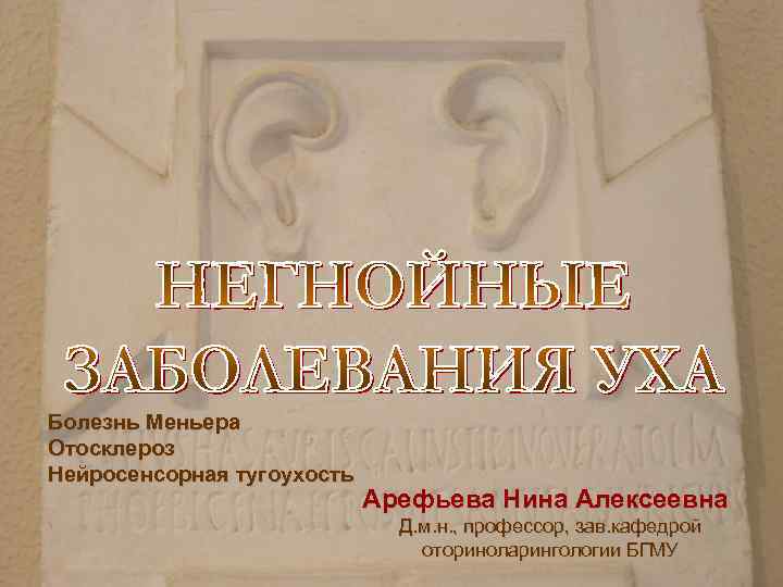 Болезнь Меньера Отосклероз Нейросенсорная тугоухость Арефьева Нина Алексеевна Д. м. н. , профессор, зав.