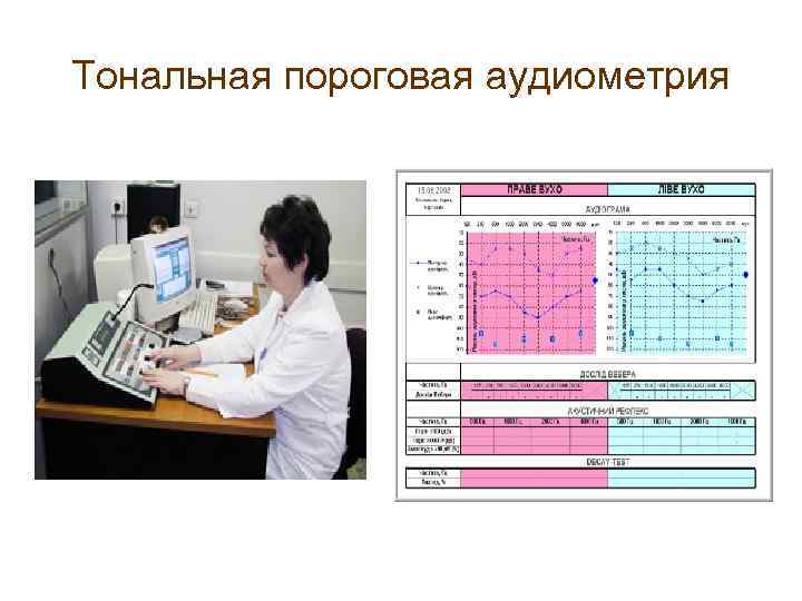 Тональная пороговая аудиометрия 