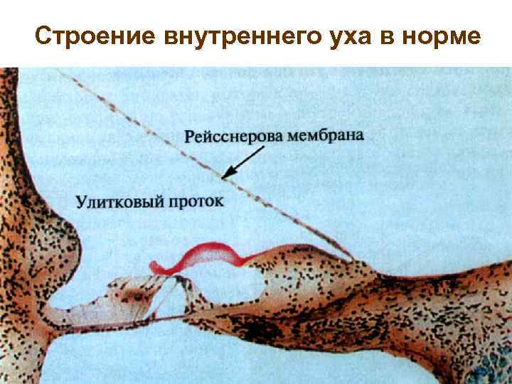 Строение внутреннего уха в норме 