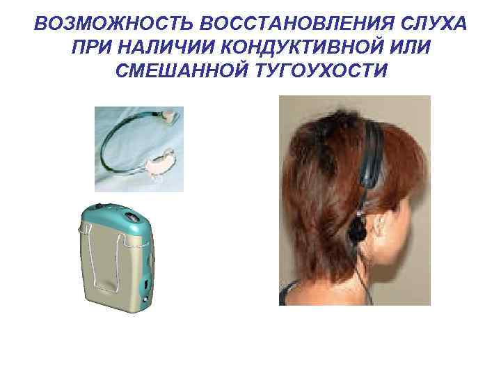 ВОЗМОЖНОСТЬ ВОССТАНОВЛЕНИЯ СЛУХА ПРИ НАЛИЧИИ КОНДУКТИВНОЙ ИЛИ СМЕШАННОЙ ТУГОУХОСТИ 