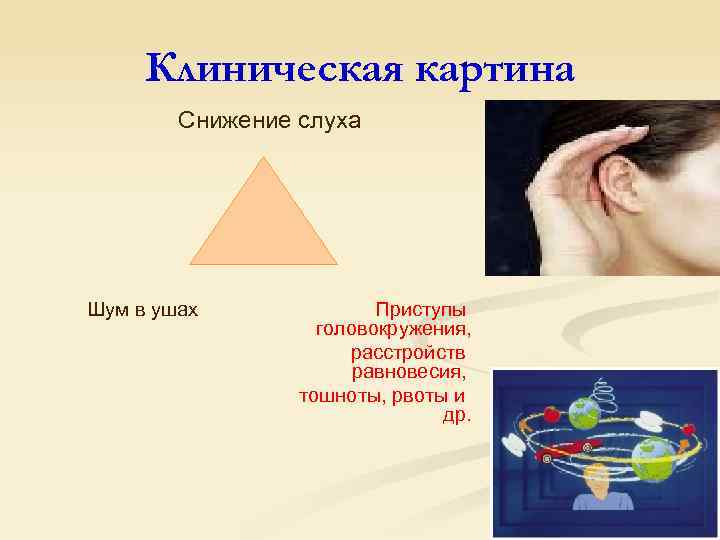 Клиническая картина Снижение слуха Шум в ушах Приступы головокружения, расстройств равновесия, тошноты, рвоты и