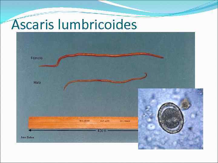 Ascaris lumbricoides 