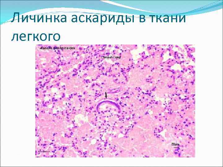 Какой цифрой обозначена на рисунке личинка аскариды в теле человека