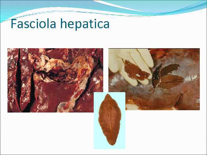 Fasciola hepatica 