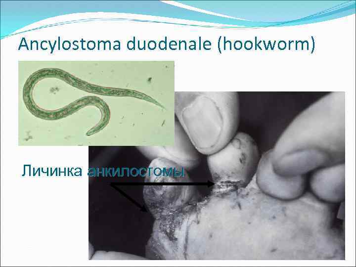 Ancylostoma duodenale (hookworm) Личинка анкилостомы 