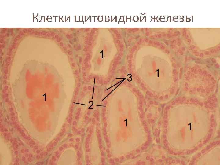 Клетки щитовидной железы 