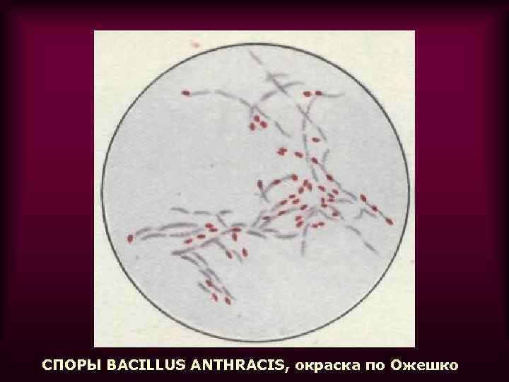 СПОРЫ BACILLUS ANTHRACIS, окраска по Ожешко 