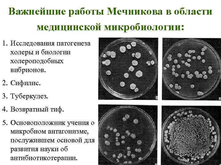 Ибп что это в микробиологии