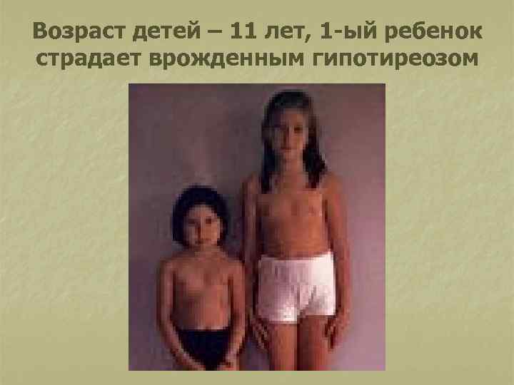 Возраст детей – 11 лет, 1 -ый ребенок страдает врожденным гипотиреозом 
