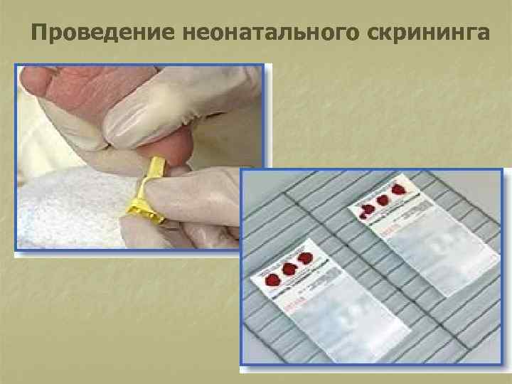 Проведение неонатального скрининга 