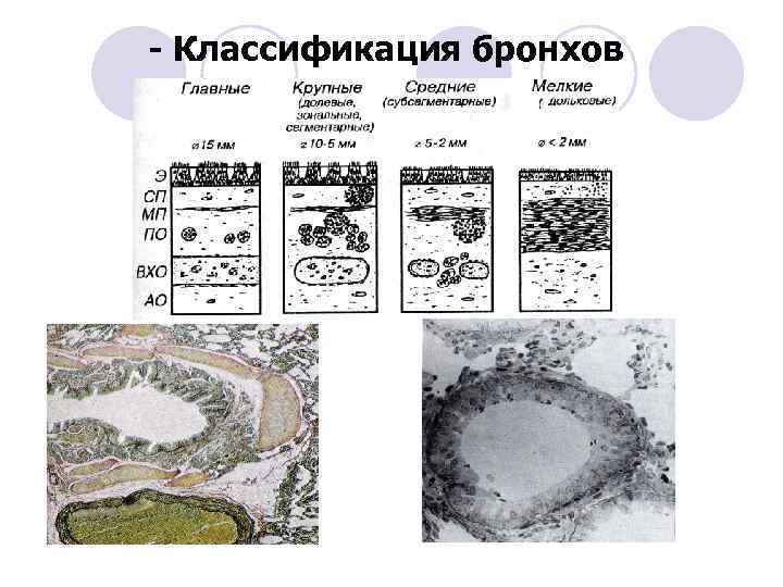 - Классификация бронхов 