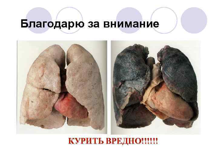 Благодарю за внимание КУРИТЬ ВРЕДНО!!!!!! 