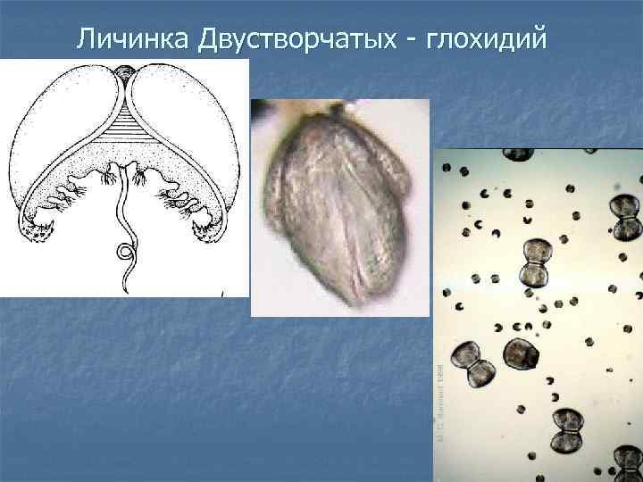Личинка Двустворчатых - глохидий 
