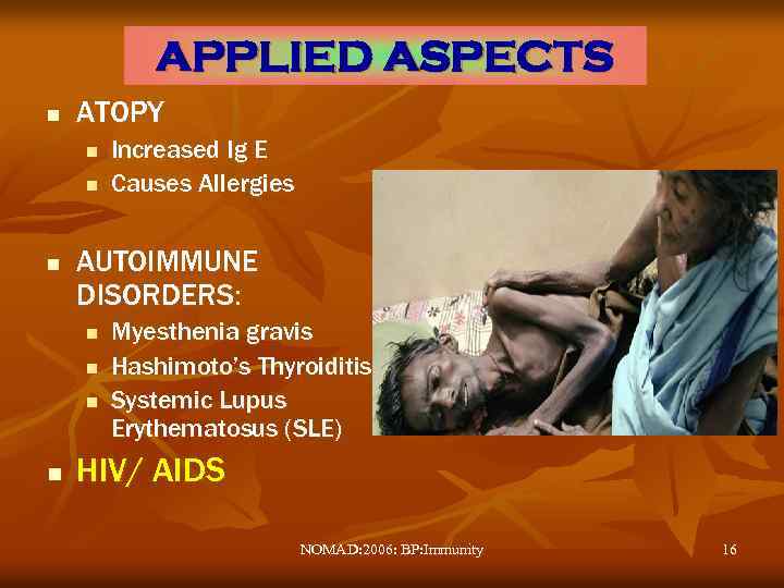 APPLIED ASPECTS n ATOPY n n n AUTOIMMUNE DISORDERS: n n Increased Ig E