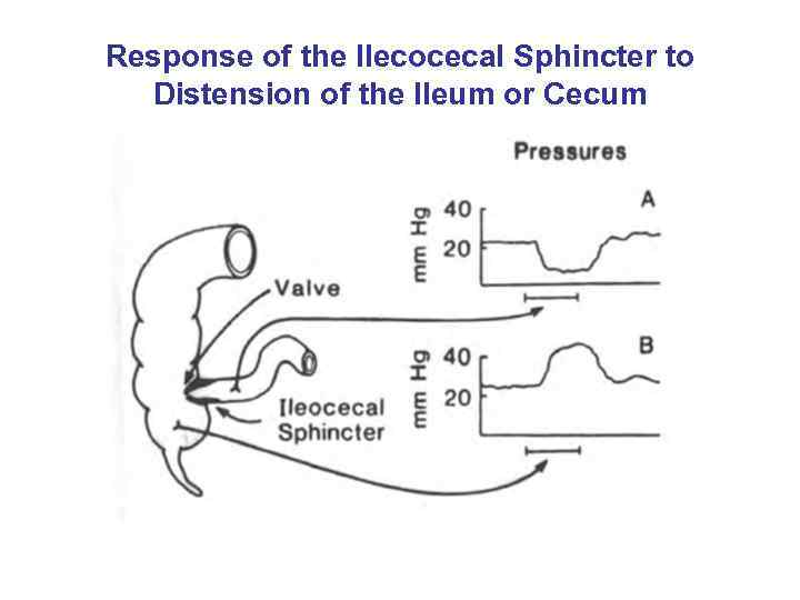Response of the Ilecocecal Sphincter to Distension of the Ileum or Cecum 