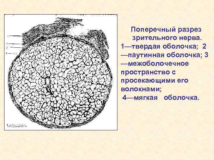 Поперечный разрез зрительного нерва. 1—твердая оболочка; 2 —паутинная оболочка; 3 —межоболочечное пространство с просекающими