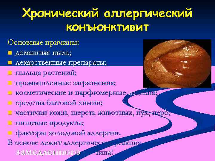 Хронический аллергический конъюнктивит Основные причины: n домашняя пыль; n лекарственные препараты; n пыльца растений;