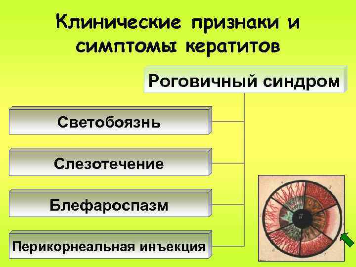 Клинические признаки и симптомы кератитов Роговичный синдром Светобоязнь Слезотечение Блефароспазм Перикорнеальная инъекция 