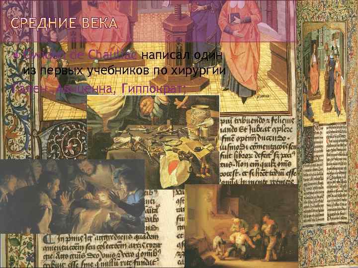  Gwidon de Chauliac написал один из первых учебников по хирургии Гален , Авиценна,