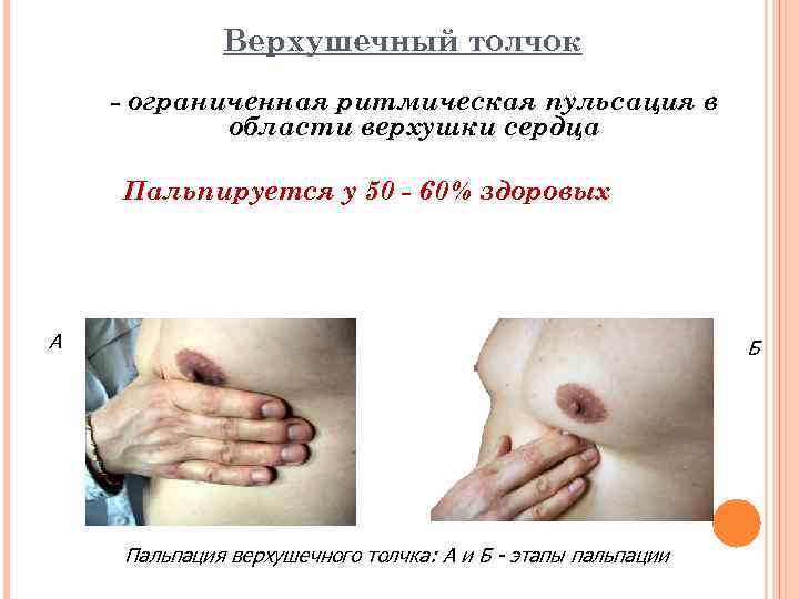 Верхушечный толчок - ограниченная ритмическая пульсация в области верхушки сердца Пальпируется у 50 -