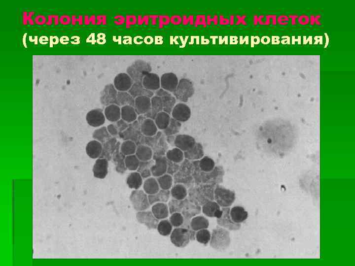Колония эритроидных клеток (через 48 часов культивирования) 
