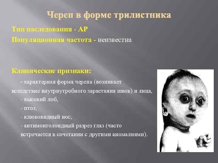 Тип наследования - АР Популяционная частота - неизвестна Клинические признаки: - характерная форма черепа