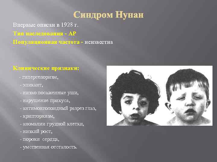 Впервые описан в 1928 г. Тип наследования - АР Популяционная частота - неизвестна Клинические