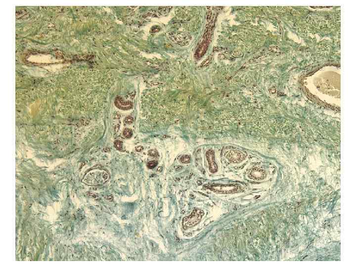 Волосы   Строение волоса   ØРазличают корень и  стержень  