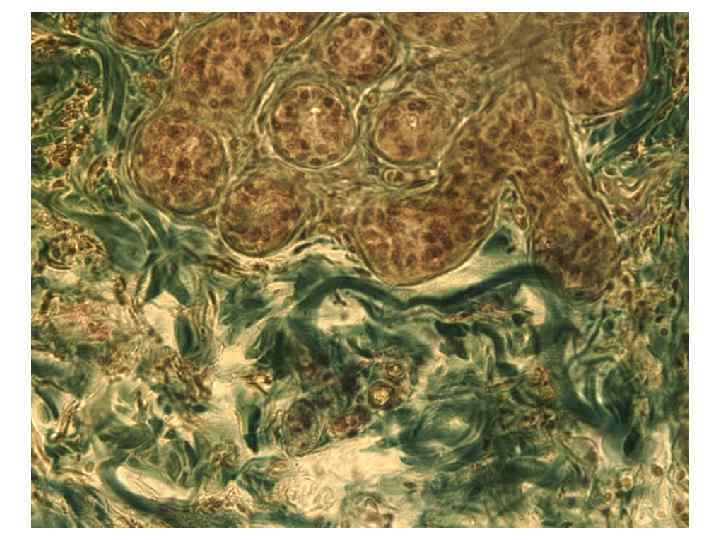 Волосяной фолликул   Комплекс пило-Руффини     Поперечный срез  