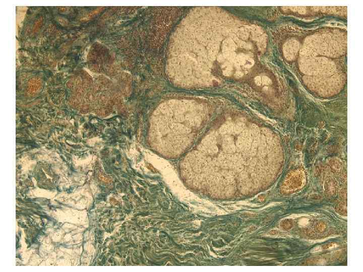 Типы волос ØЛануго (первичные волосы), от лат. luna — шерсть ØДлинные (волосы головы, бороды,