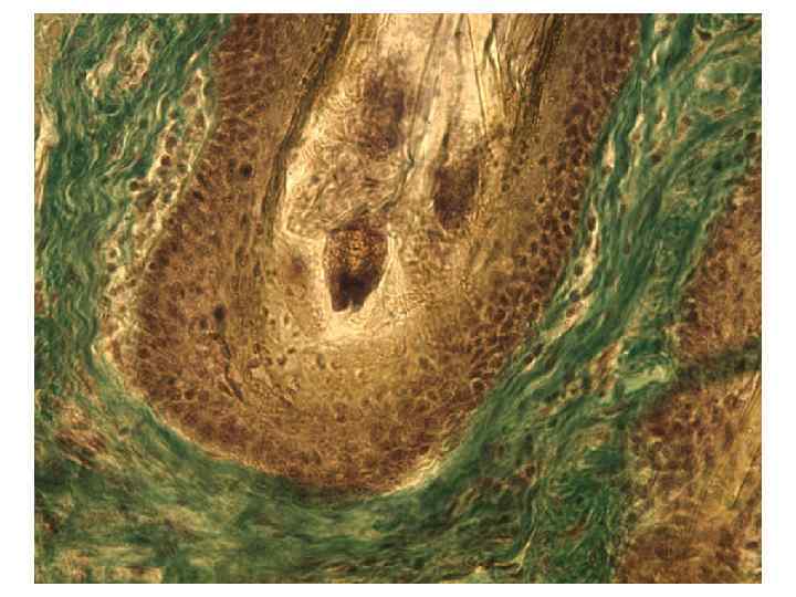     Первичные афферентные волокна А волокна (15 -20 мкм)  мышечные
