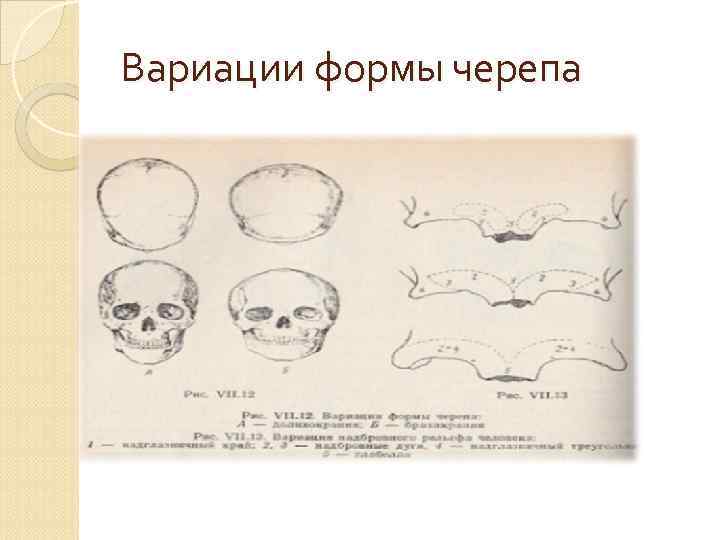 О чем говорят формы черепа. Классификация людей по форме черепа. Форма черепа человека виды.