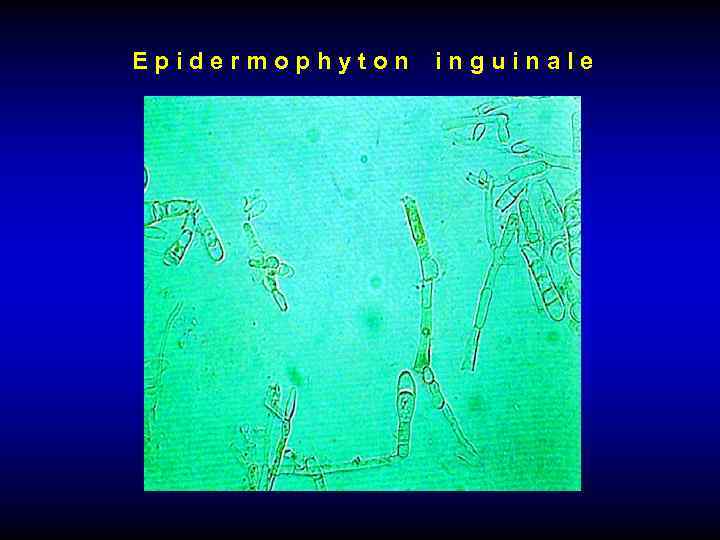 Epidermophyton inguinale 