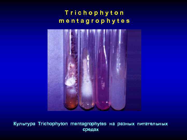 Trichophyton mentagrophytes Культура Trichophyton mentagrophytes на разных питательных средах 