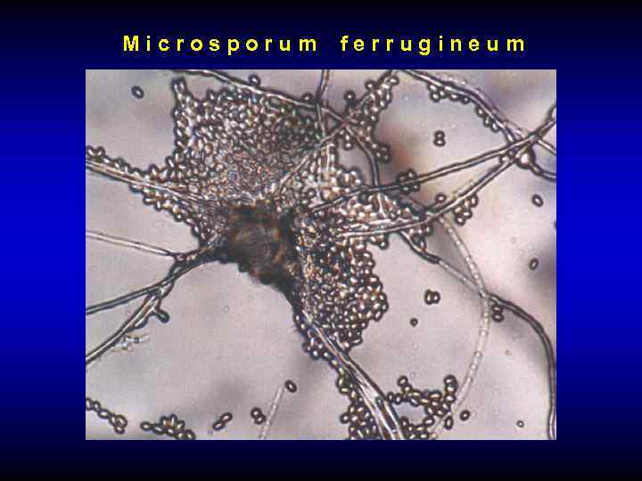 Microsporum ferrugineum 