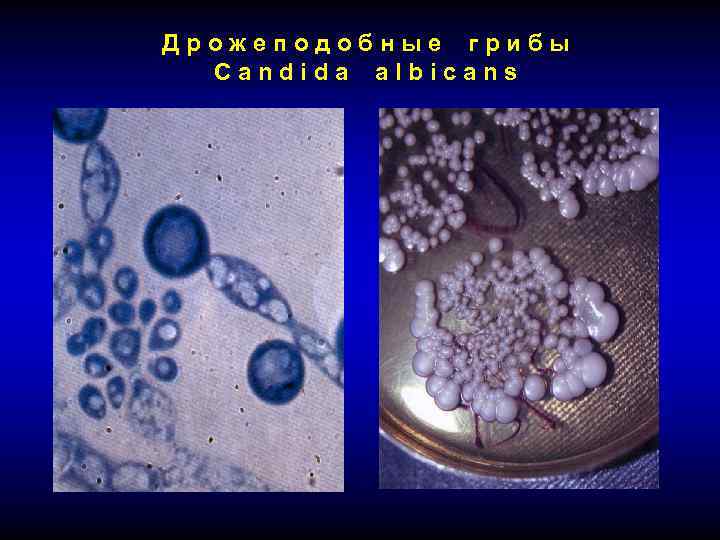 Дрожеподобные грибы Candida albicans 