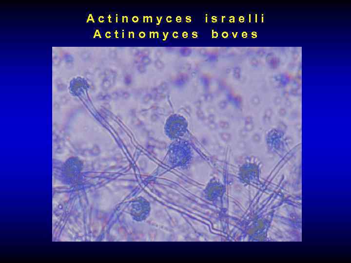 Actinomyces israelli Actinomyces boves 