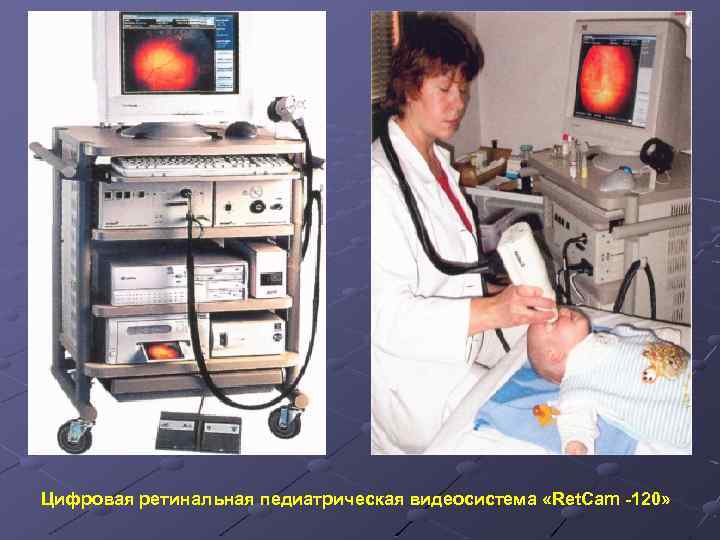 Цифровая ретинальная педиатрическая видеосистема «Ret. Cam 120» 