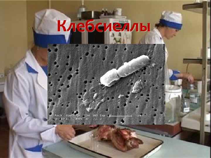 Клебсиеллы 