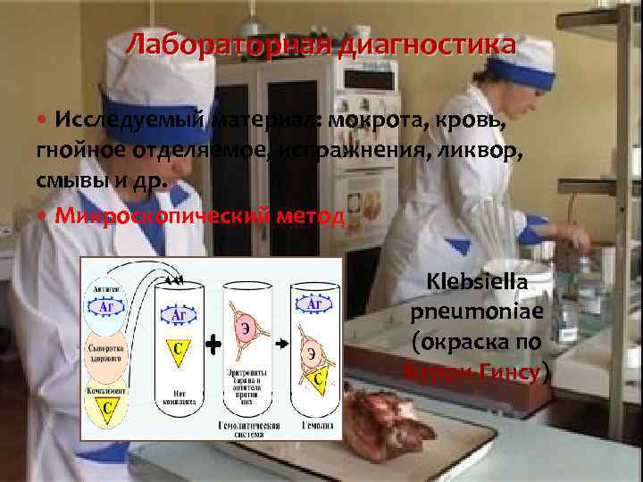 Лабораторная диагностика Исследуемый материал: мокрота, кровь, гнойное отделяемое, испражнения, ликвор, смывы и др. Микроскопический