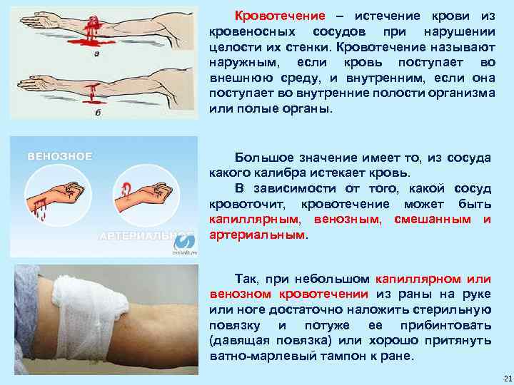 Кровотечение – истечение крови из кровеносных сосудов при нарушении целости их стенки. Кровотечение называют