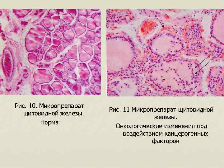 Под изменения