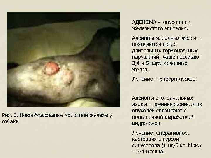 АДЕНОМА - опухоли из железистого эпителия. Аденомы молочных желез – появляются после длительных гормональных