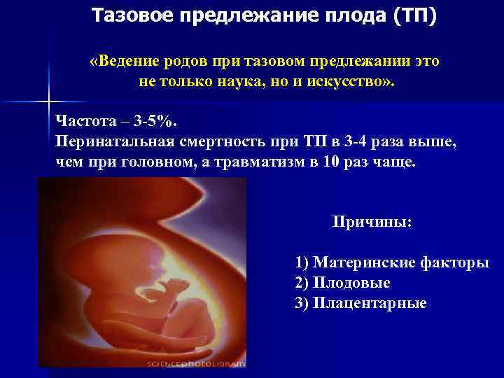 Тазовое предлежание плода (ТП) «Ведение родов при тазовом предлежании это не только наука, но