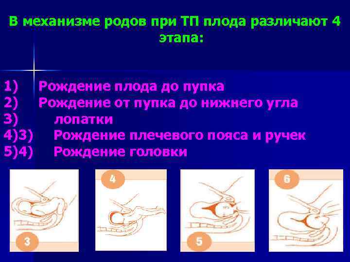 В механизме родов при ТП плода различают 4 этапа: 1) Рождение плода до пупка